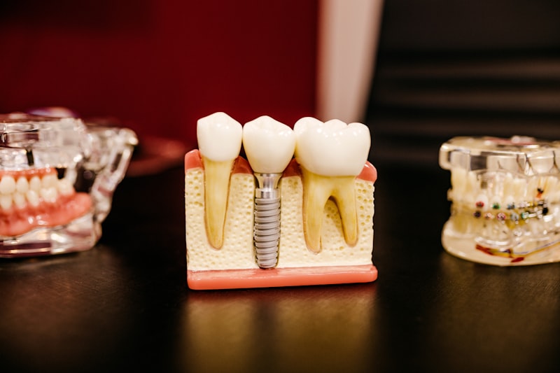 Bone grafting procedure for dental implants at Fort Worth Dental TX