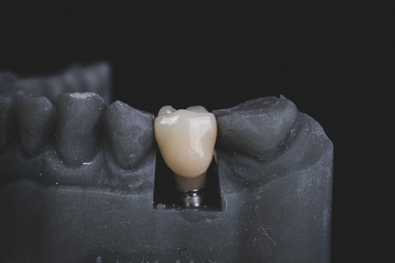 Dental bone grafting material and jawbone restoration in Fort Worth Texas