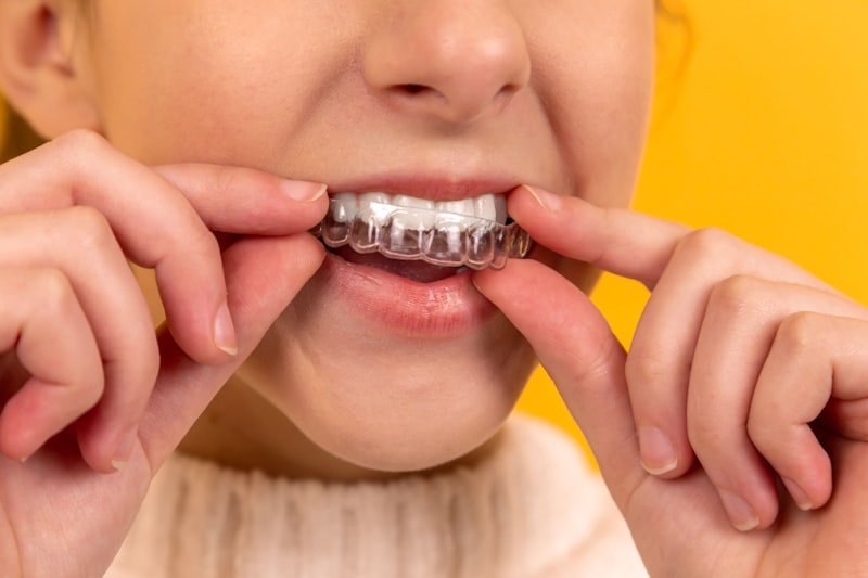 Teeth grinding bruxism treatment Fort Worth TX - Patient suffering from jaw pain and tooth wear due to nocturnal teeth clenching