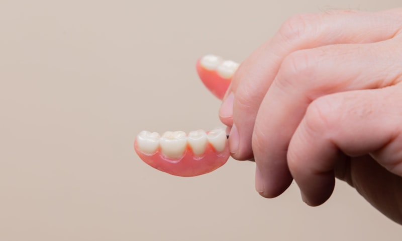 Full and partial dentures Fort Worth TX - Custom removable teeth replacement for natural looking smile