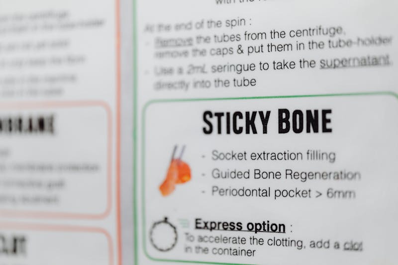 Guided tissue regeneration process - Rebuilding bone and gum tissue for dental implant support