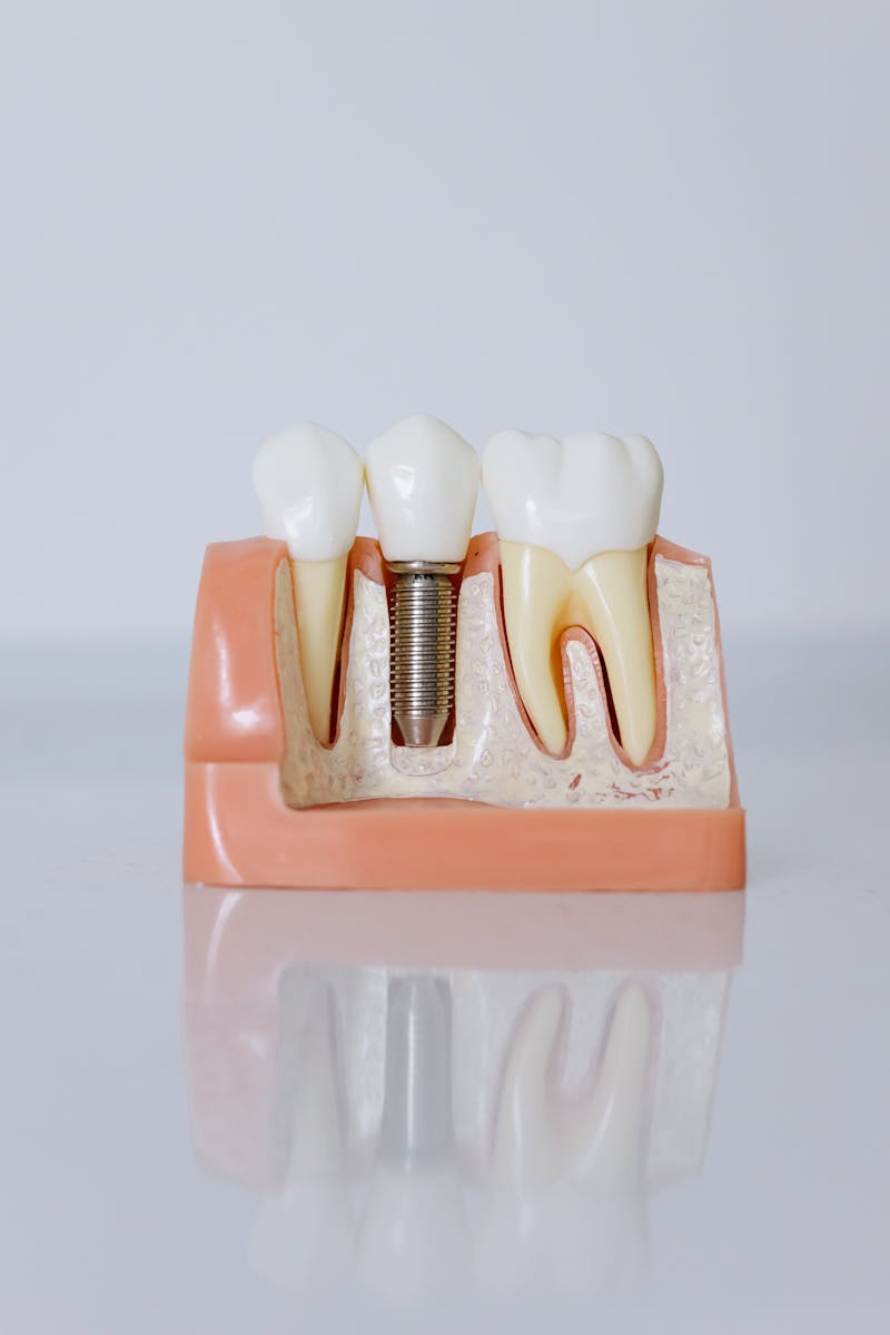 When Root Canal Needed