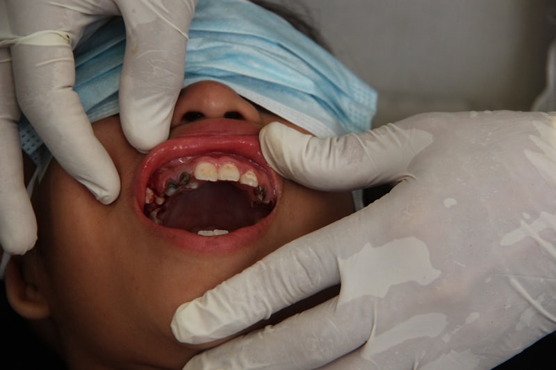 Sedation Dentistry
